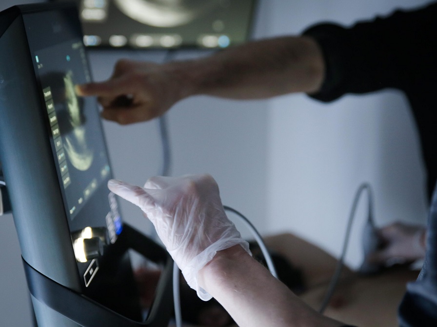 Ultrasound Teaching Sonogram