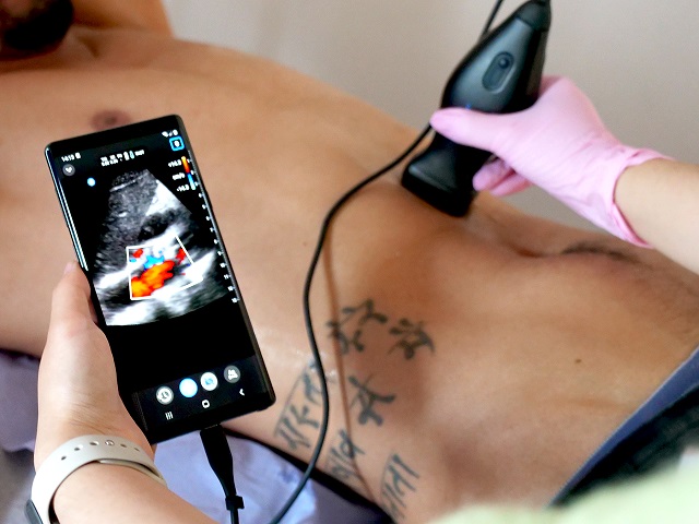 Ultrasound for Surgeons Handheld Probe
